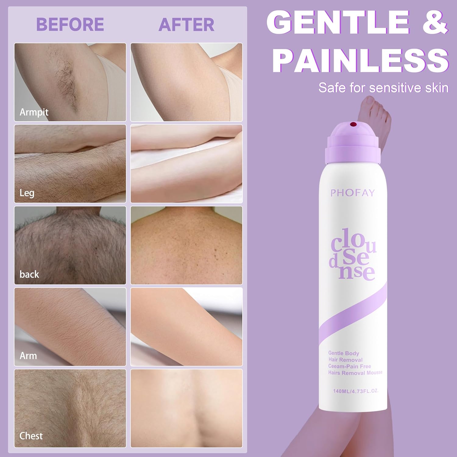 Before and after examples for armpit, leg, back, arm and chest