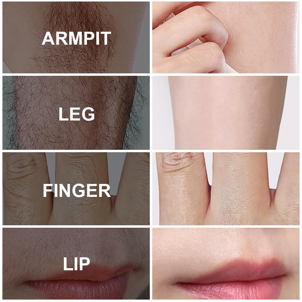 Hair removal examples for armpit, leg, finger and upper lip